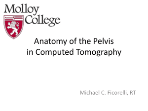 Anatomy of the Chest in Computed Tomography