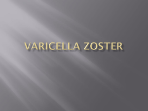 Varicella zoster - faculty development