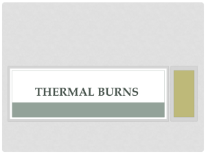 Thermal Burns - yeditepetip4