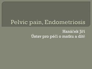 Pelvic pain, Endometriosis