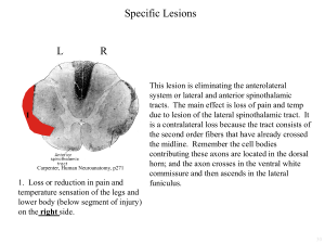 Test yourself on lesions in section pictures (includes explanation)