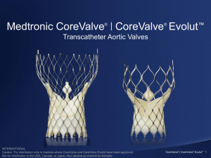 CoreValve and CoreValve Evolut Valves