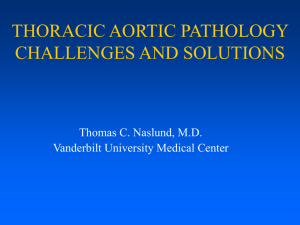 Thoracic Aorta Pathology