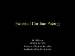 External Cardiac Pacing
