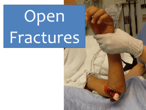 management of open fractures