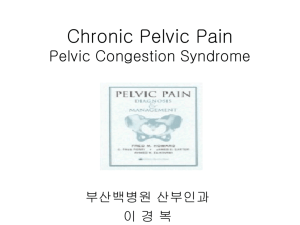 Chronic Pelvic Pain Pelvic Congestion Syndrome