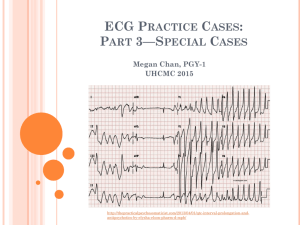 ECG Practice Cases Part 3 Special Cases