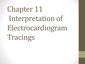 Chapter 11 Interpretation of Electrocardiogram Tracings