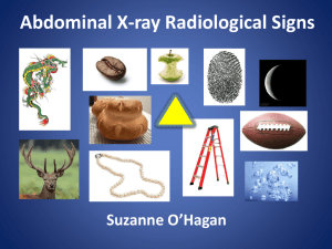 Abdominal X-ray Radiological Signs
