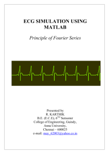 ECG