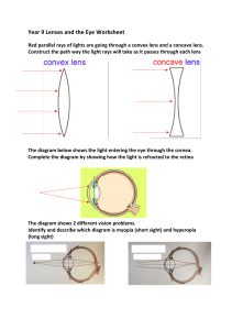 Lenses and the eye worksheet