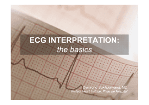 ECG interpretation
