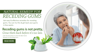 Receding Gums Remedy