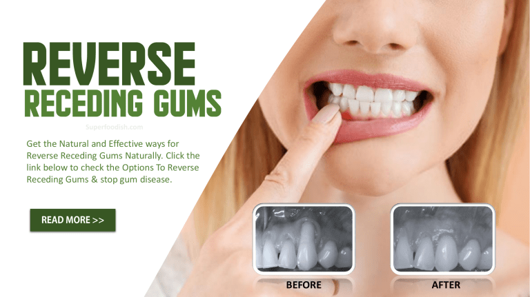 receding-gums-reverse