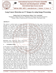 Lung Cancer Detection on CT Images by using Image Processing
