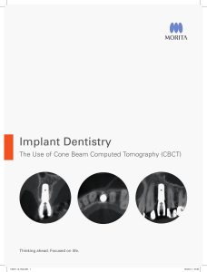 Brochure Implant Dentistry