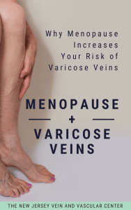 The Relation Between Menopause and Risk of Varicose Veins