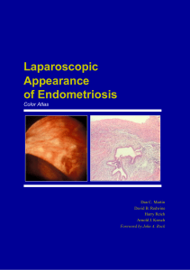 Laparoscopic Appearance of Endometriosis 