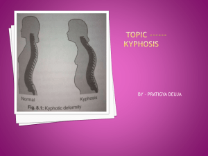 kyphosis-190407092639