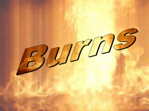 8. Burns