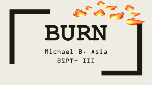 BURN-IE Michael