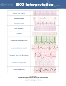 10 Common EKG Heart Rhythms