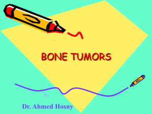 bone-tumors