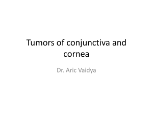 Tumors of conjunctiva and cornea