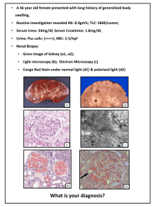 Renal Biopsy Case Study: Diagnosis