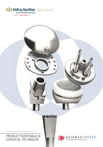 GLOBAL UNITE Shoulder Arthroplasty Surgical Technique