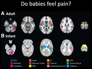 Do Babies Feel Pain? Neurological Evidence from Adult vs. Infant Brain Scans