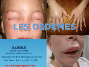 Les &oelig;d&egrave;mes : physiopathologie et &eacute;tiologies