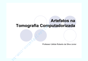 Artefatos na Tomografia Computadorizada: Guia Completo