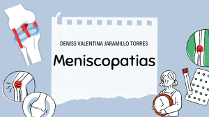Meniscopat&iacute;as: Definici&oacute;n, Anatom&iacute;a y Tratamiento