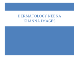 Dermatology Neena Khanna Images: Lesion Definitions & Conditions